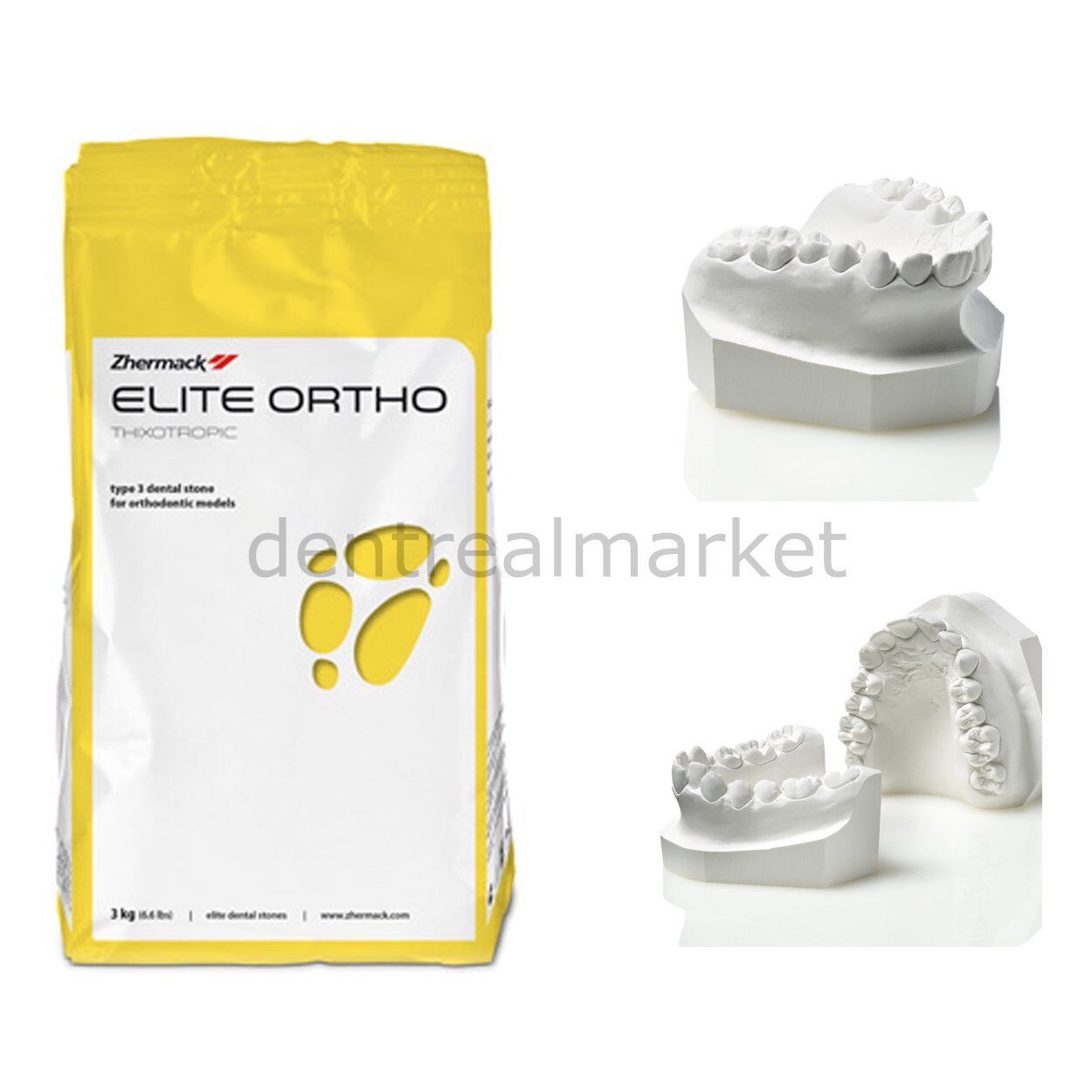 Elite Ortho Ortodontik Beyaz Alçı - 3 kg- Type 3