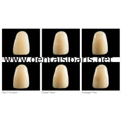 Charisma Classic Kompozit Set 8x4 gr & 1 Adet Universal Bond