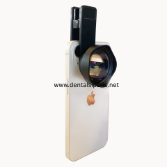 Dental Macro Telefon Lensi - 75 mm